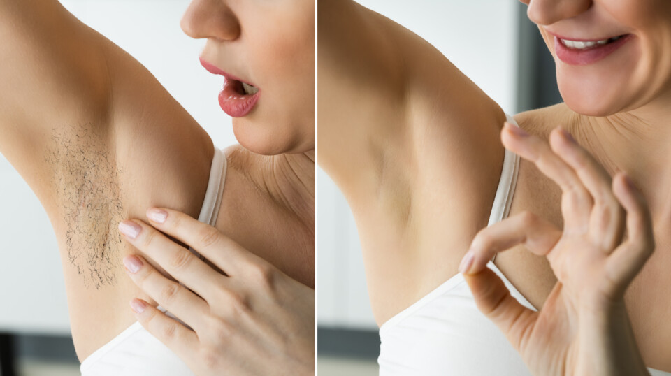 Before and after armpit hair removal