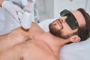 Laser hair removal for male chest