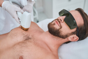 laser hair removal breast man