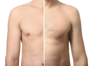 Half portrait of male torso, hairy and hairless.