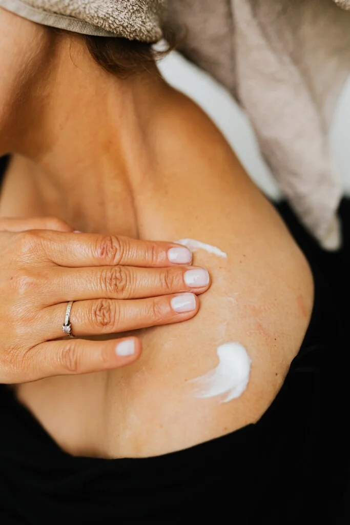 Erste Hilfe bei Sonnenbrand