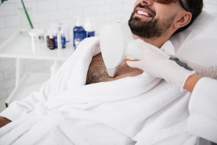 Laser hair removal for men: This is what you need to know