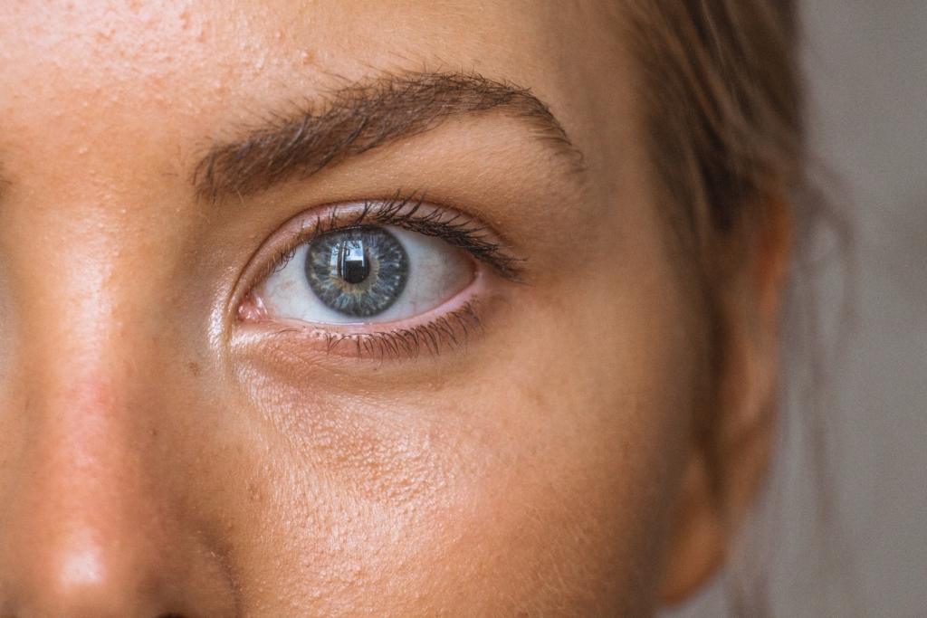 Microneedling gegen Augenringe