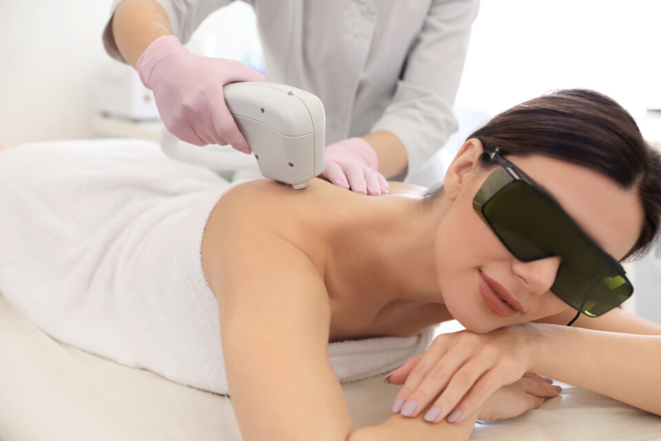 laser hair removal on the back