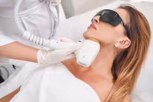 laser hair removal chin