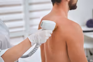 Laser-Haarentfernung bei Mann im Studio.