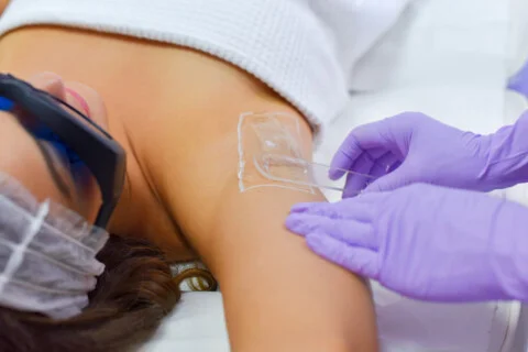 Laser hair removal Berlin Mitte