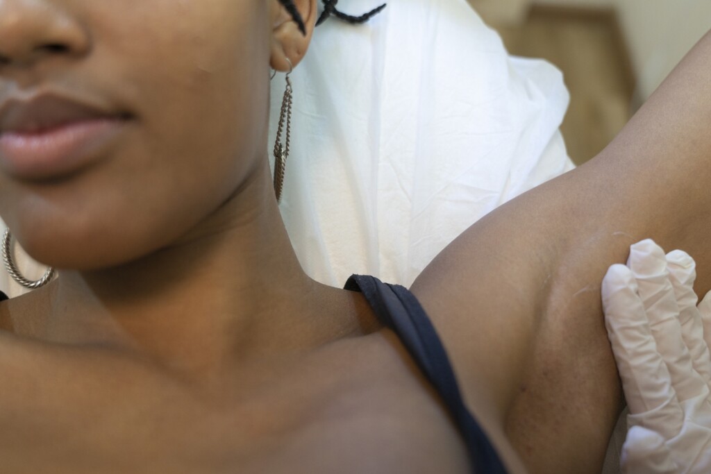 A woman's armpit is treated with care product