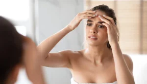 Pimples after ovulation: This is what you can do