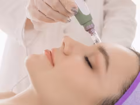 Gesichtsbehandlung - Microneedling